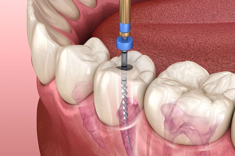 Dentsity Cosmetic And Dental Speciality Clinic