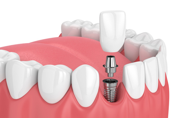 Dentsity Cosmetic And Dental Speciality Clinic