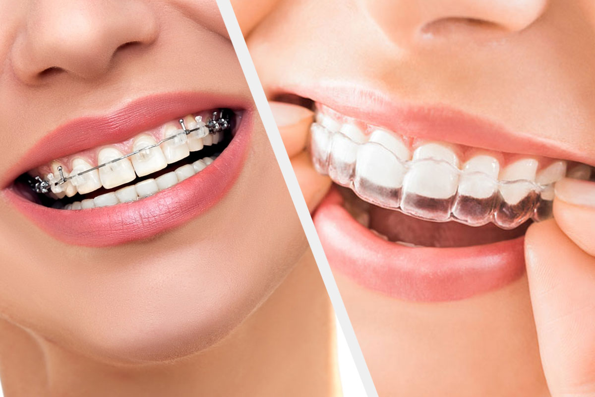 Dentsity Cosmetic And Dental Speciality Clinic